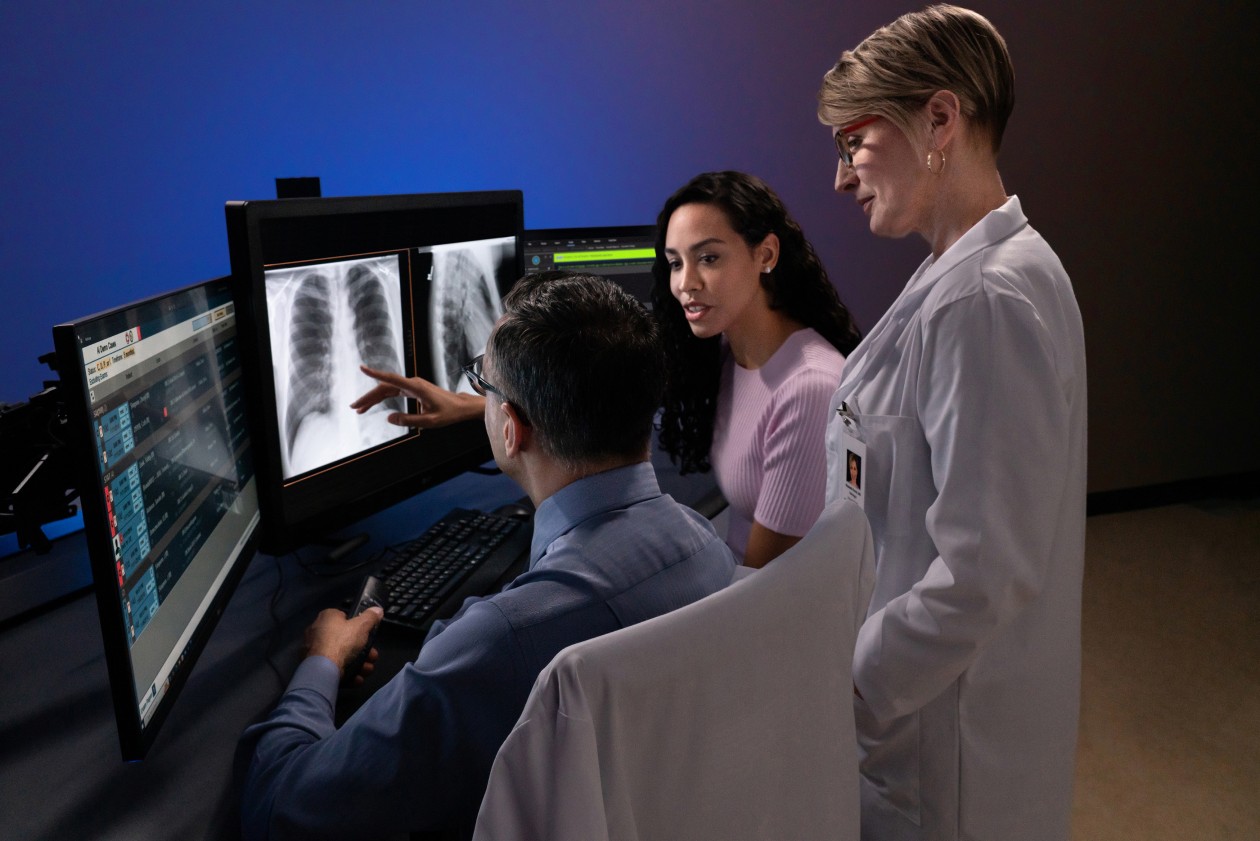Three colleagues working together viewing chest x-rays