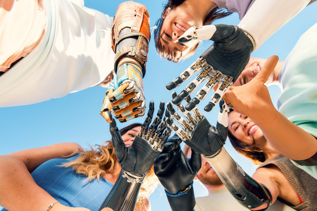 Several people stand in a circle with their hands extended toward the center, including multiple prosthetic arms and hands, photographed from below against a blue sky.
