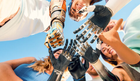 Several people stand in a circle with their hands extended toward the center, including multiple prosthetic arms and hands, photographed from below against a blue sky.